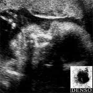 DENSO - 090515 / Aglaia download free DENSO - 090515 / Aglaia download mp3 flac